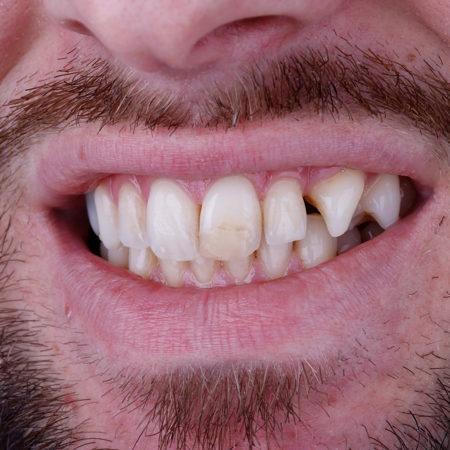 Before treatment
